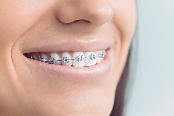 Trusted West Bend, WI Holistic Dental Care Services Experts